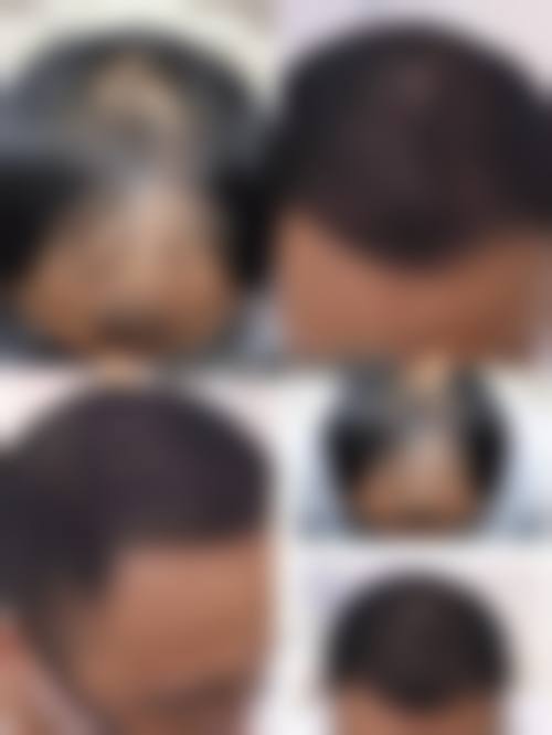 北京科发源植发专科医院预约挂号方式