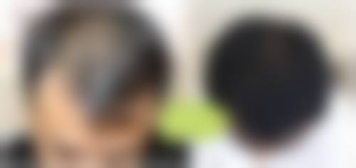 北京科发源植发专科医院特色诊疗项目与技术优势