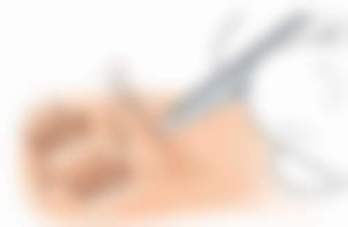 南京鼓楼众一口腔诊所郑婷医生项目收费价格