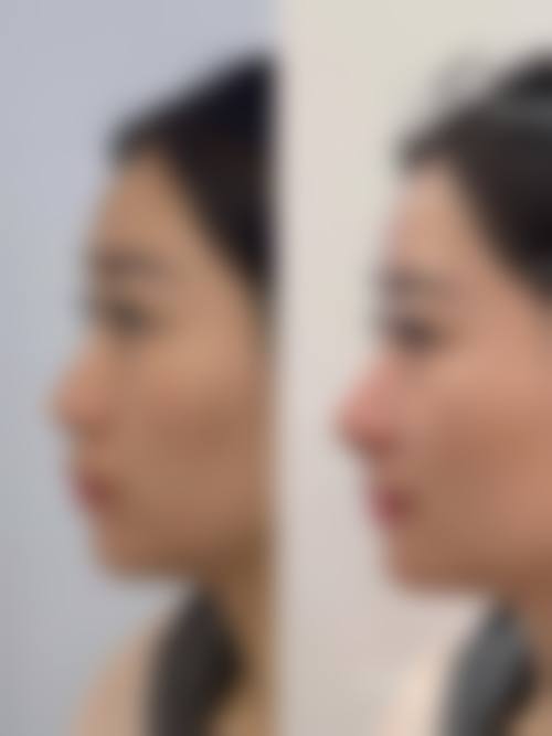 南昌左梵整形医院预约挂号方式