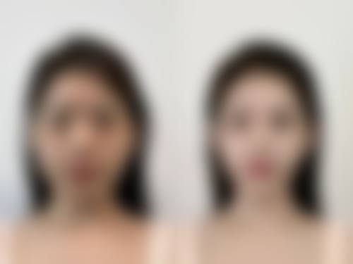 朴成奕医生技术优势