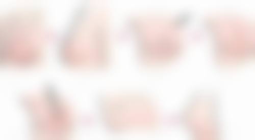 阳江臻美医疗美容诊所收费价格表