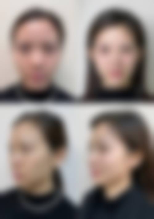 朴成奕医生项目收费价格