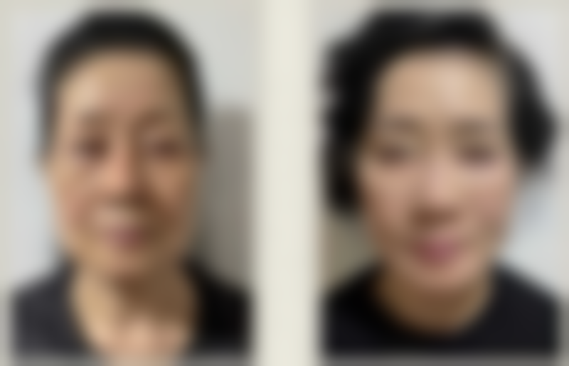 朴成奕医生口碑评价及反馈内容