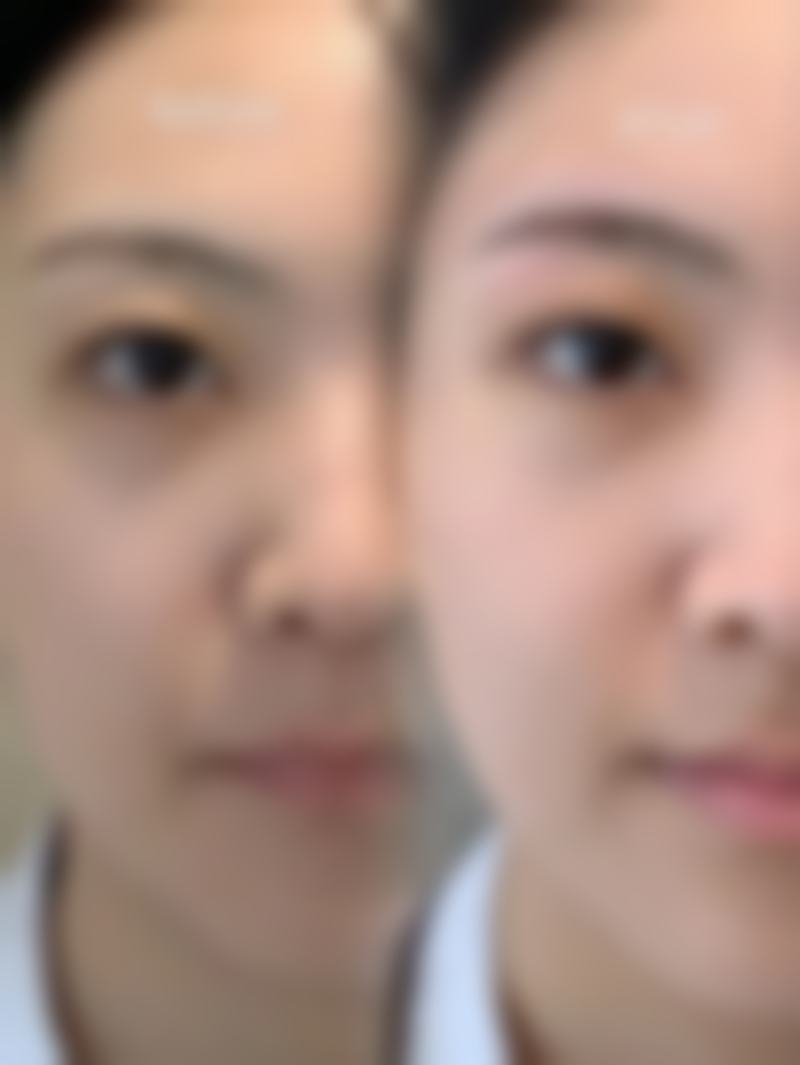 于之龙医生项目收费价格