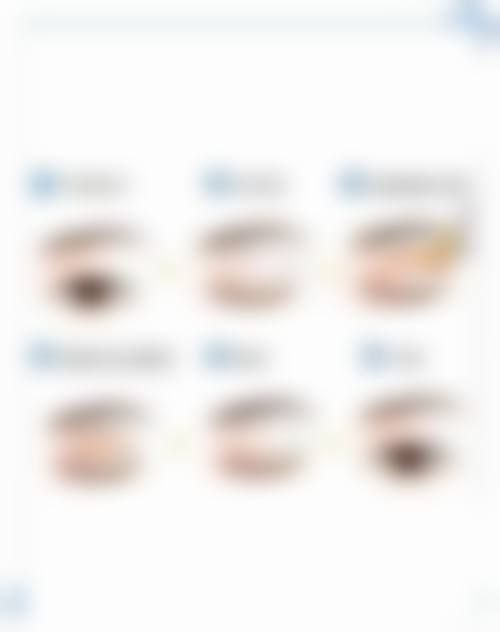 唐艳杰医生技术优势