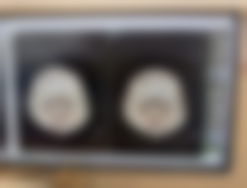 浙江嘉兴平湖爱尚口腔诊所收费价格表