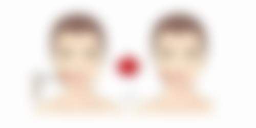 谢秋梅医生项目收费价格