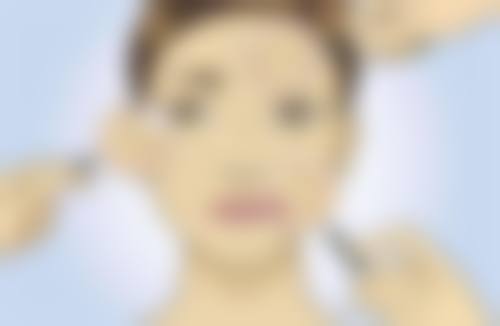 郑承镐医生预约挂号