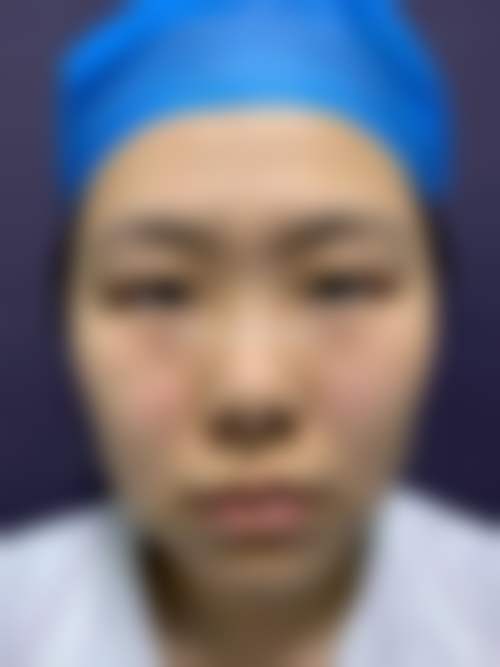 阿克苏唯星颜医疗美容门诊部预约挂号方式