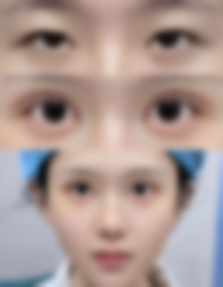 阿克苏唯星颜医疗美容门诊部收费价格表