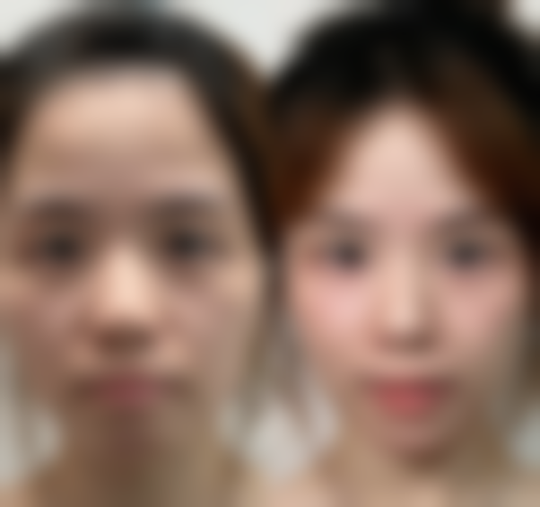 烟台刘芳医学整形美容中 心预约挂号方式