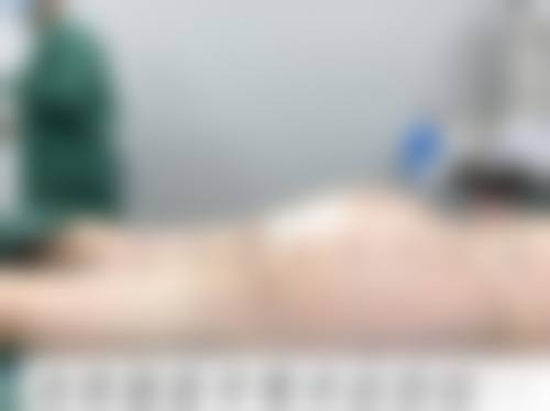 秋在镐医生技术优势