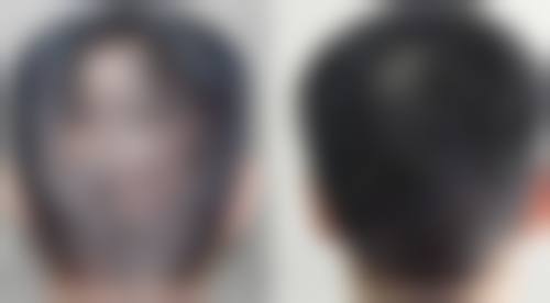 厦门美莱整形医院收费价格表