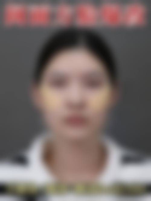 潘福强医生项目收费价格