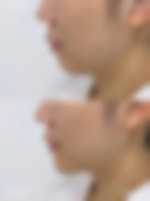 潘福强医生技术优势