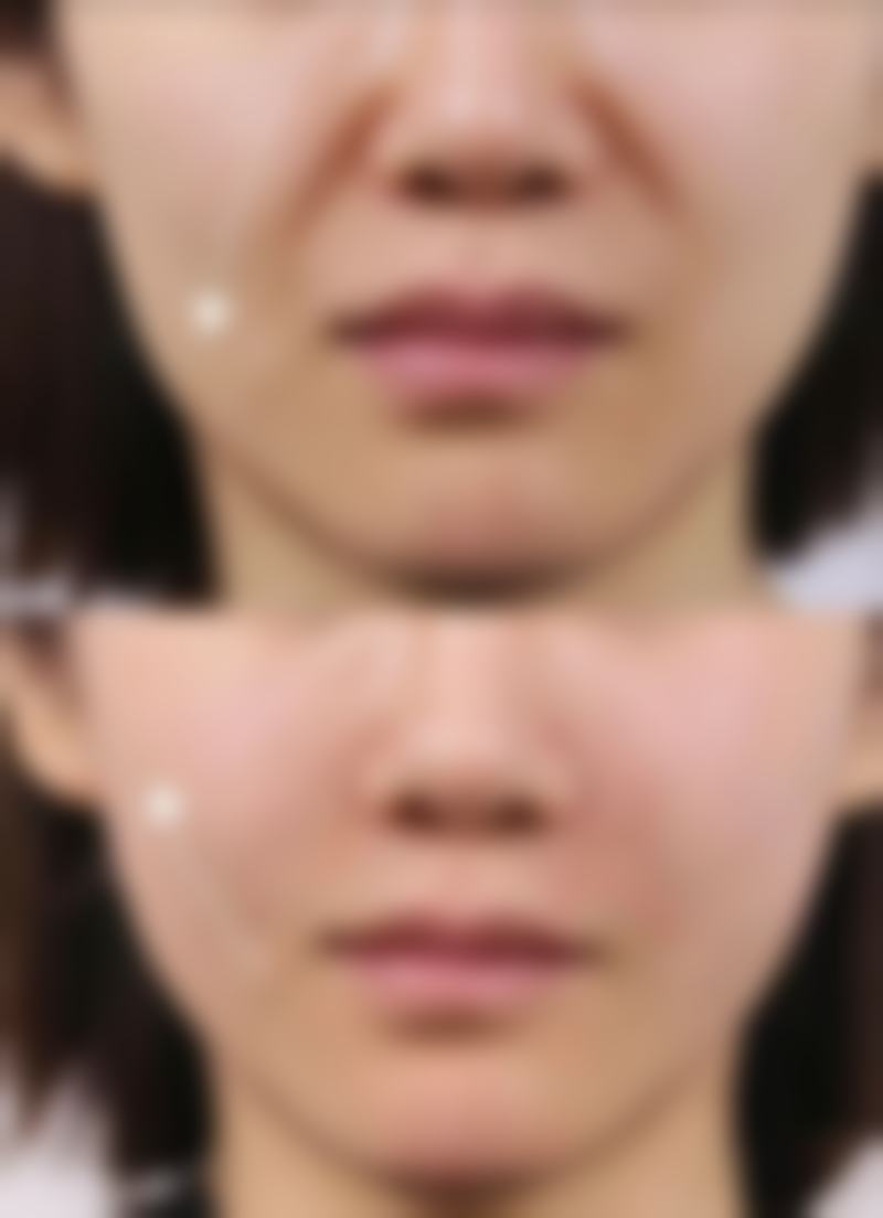 阜南县妇幼保健院预约挂号方式