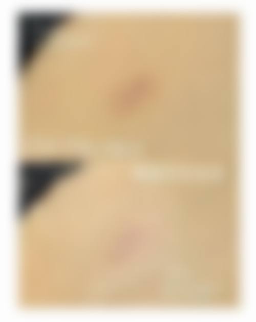 张芳勇医生技术优势