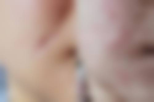 张芳勇医生预约挂号