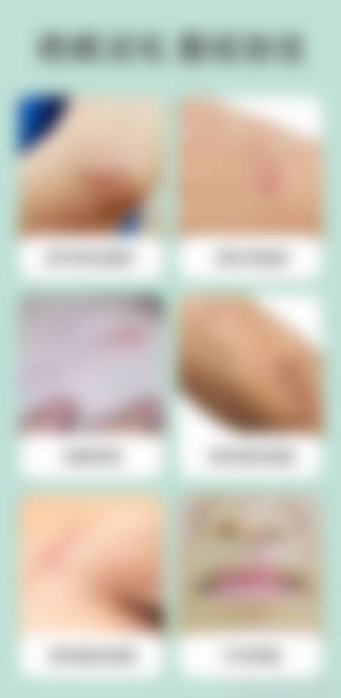 张芳勇医生口碑评价及反馈内容