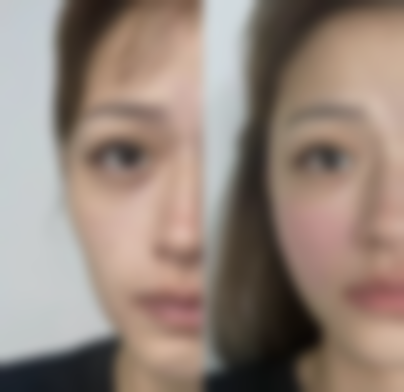 韩国balance整形外科医院特色诊疗项目与技术优势