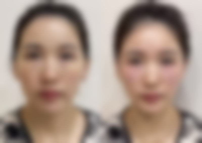 刘登田医生项目收费价格