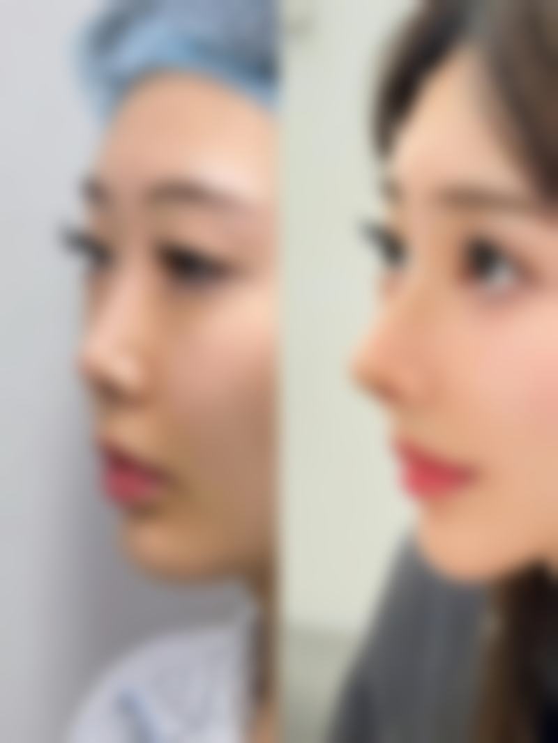 武汉匠星整形美容收费价格表