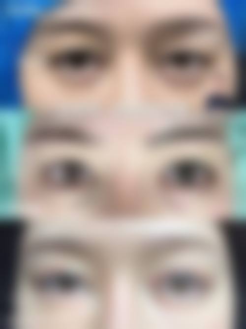 熊员平医生预约挂号