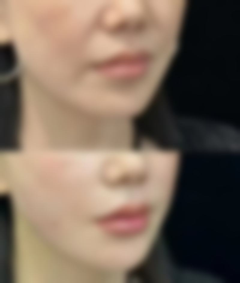 东莞伊嘉医疗美容特色诊疗项目与技术优势