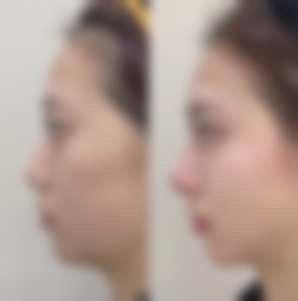 陈中医生预约挂号