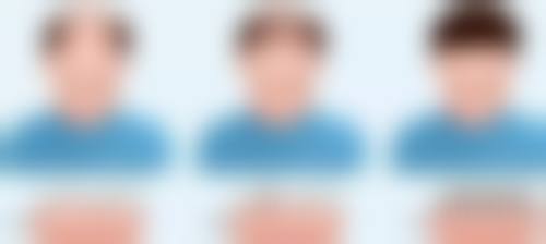 邢台市巨鹿县医院医学美容科收费价格表