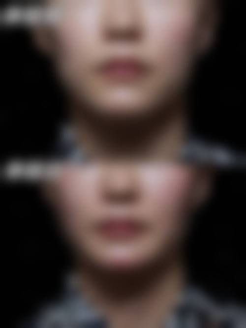 金均泰医生项目收费价格