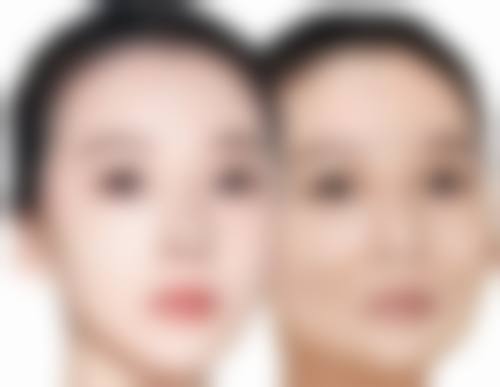 朴成奕医生项目收费价格