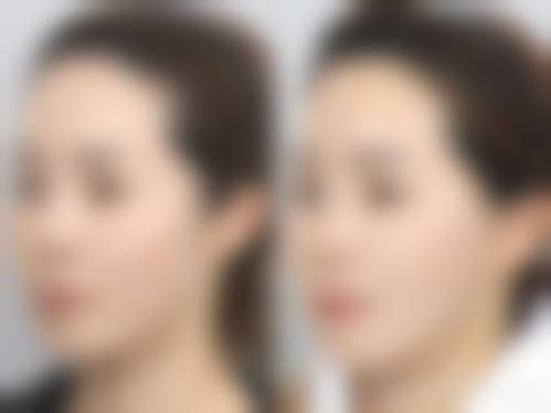 金泳泰医生技术优势