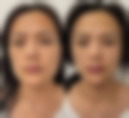 朴成奕医生口碑评价及反馈内容