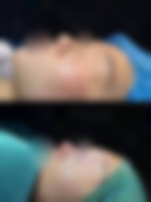 钟雷医生技术优势