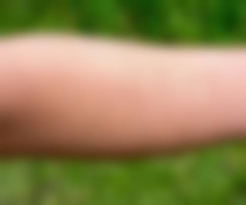 于德宝医生项目收费价格