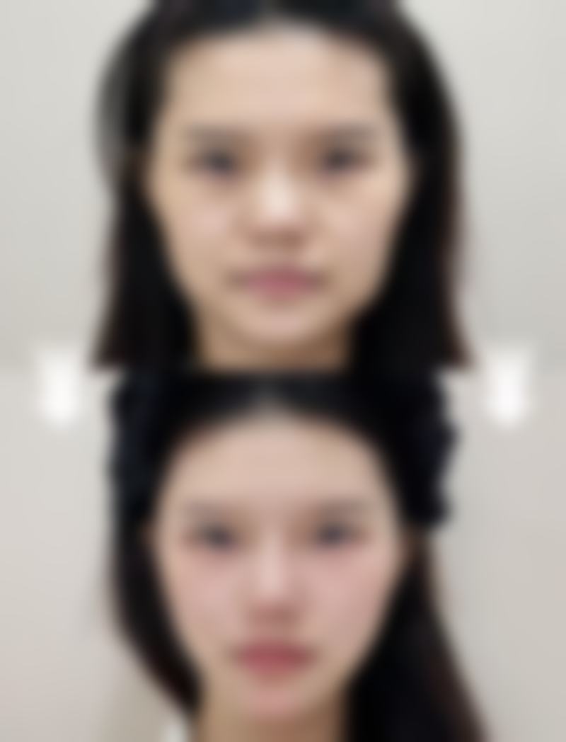 杭州千颜整形医院收费价格表