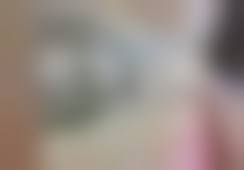 庄姚姿医生项目收费价格