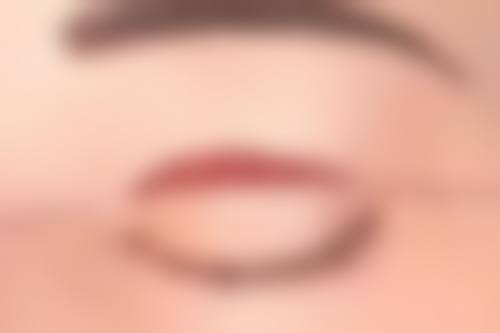 胡克林医生项目收费价格