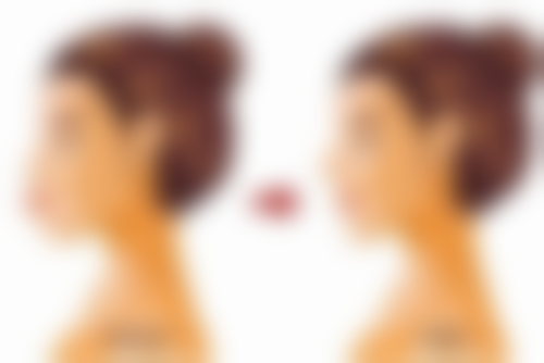 巴友良医生项目收费价格