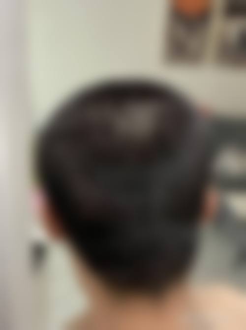 徐州新生植发医院医生团队介绍