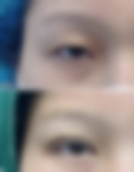 黄学峰富贵包（原诗璐）预约挂号方式