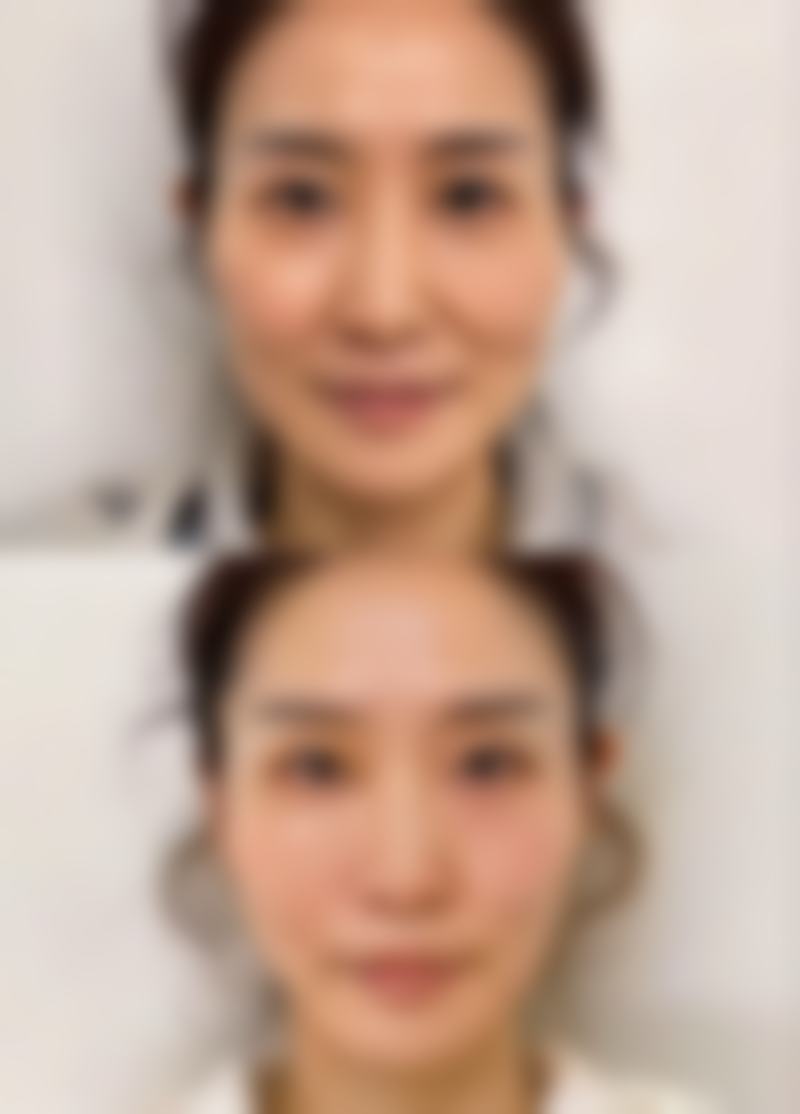 黄梓涵医生技术优势