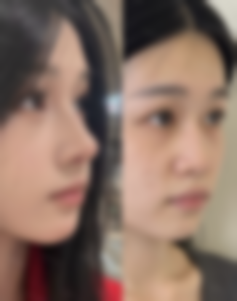 吴祥祿医生技术优势