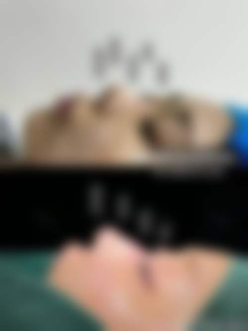 唐山张小熊医疗美容门诊部顾客实例展示