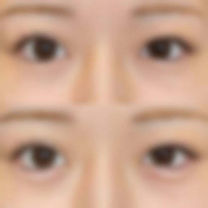 芜湖壹加壹医疗美容医院收费价格表