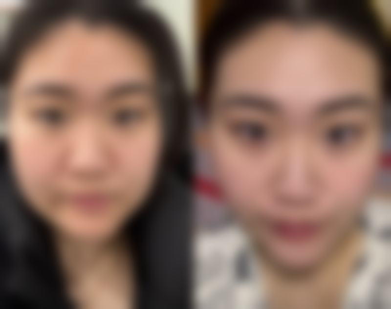 于之龙医生技术优势