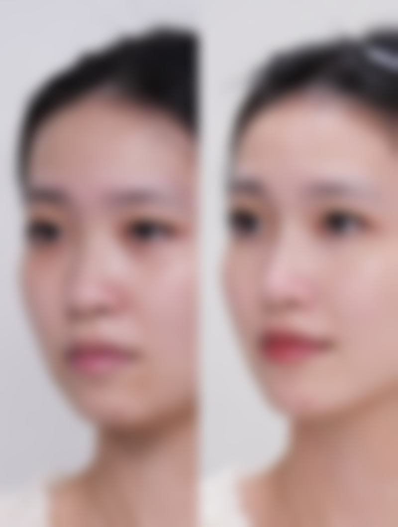 韩国Reborn整形外科医院特色诊疗项目与技术优势