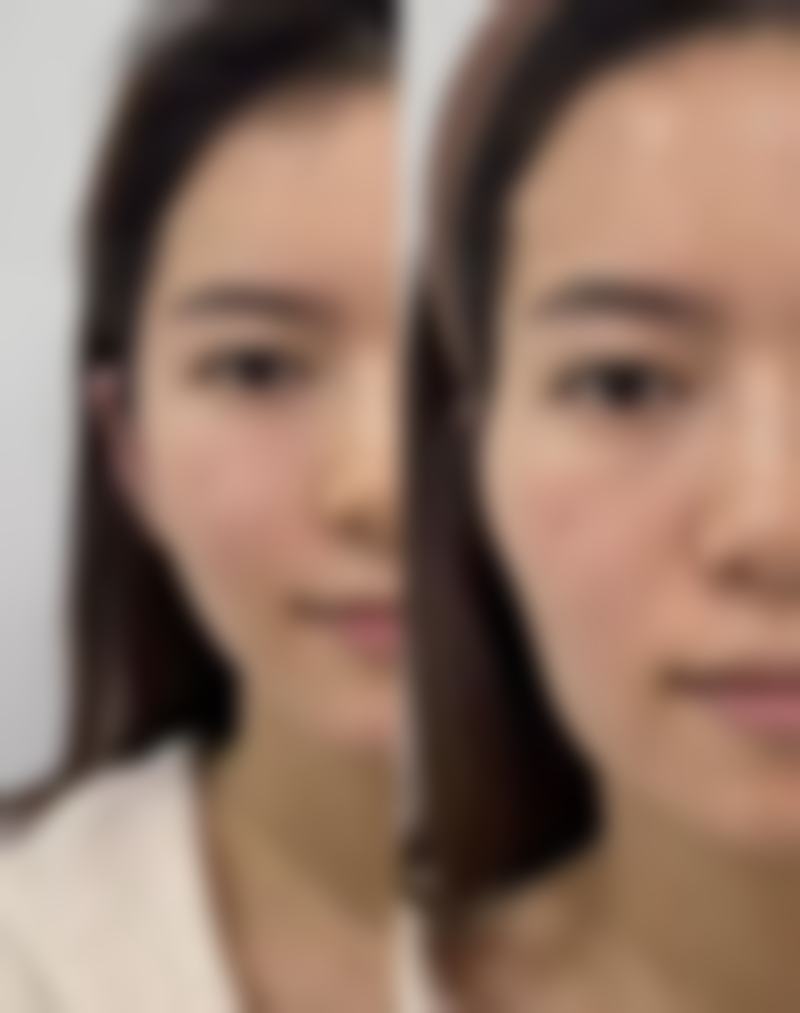 新疆医科大学第一附属医院烧伤整形科收费价格表